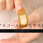アルコールで手荒れ|アルコール除菌で手荒れしない方法とは?